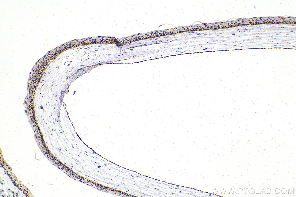 IHC staining of rat eye using 11129-1-AP