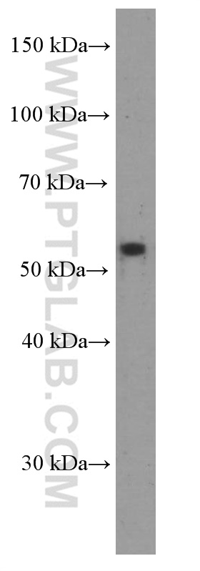 WB analysis of A549 using 66306-1-Ig