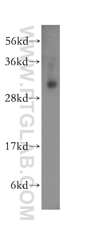 WB analysis of K-562 using 11365-1-AP
