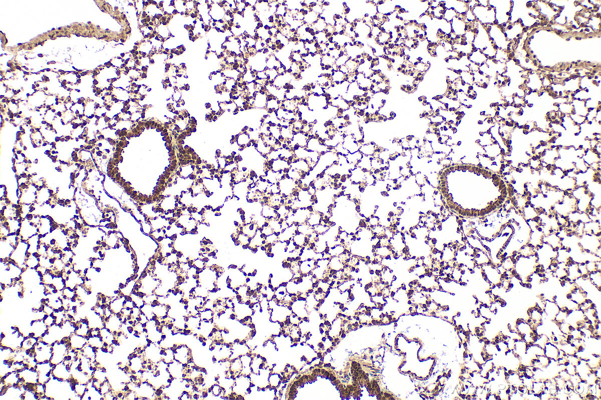 IHC staining of mouse lung using 22138-1-AP
