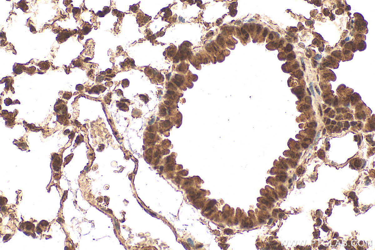 IHC staining of mouse lung using 22138-1-AP