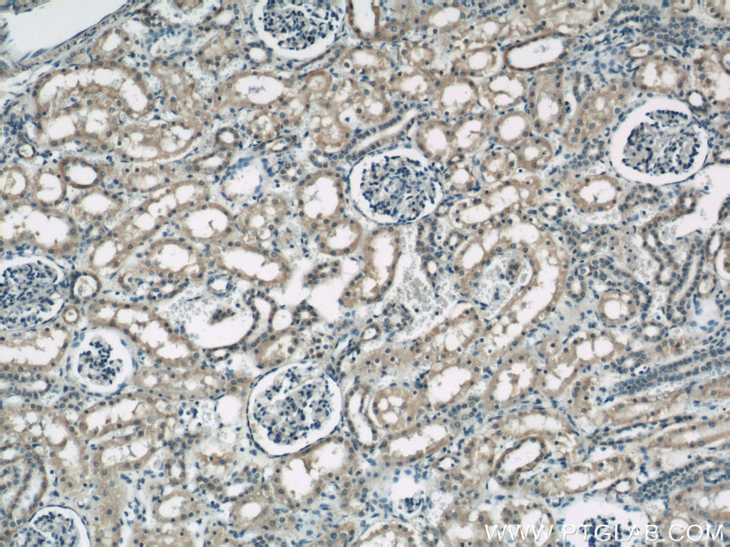 IHC staining of human kidney using 22138-1-AP