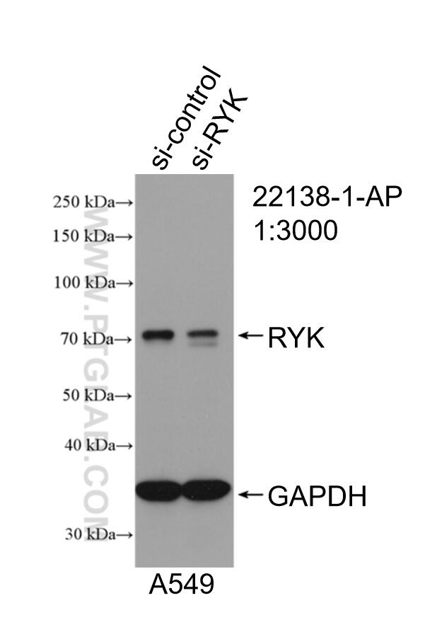 WB analysis of A549 using 22138-1-AP