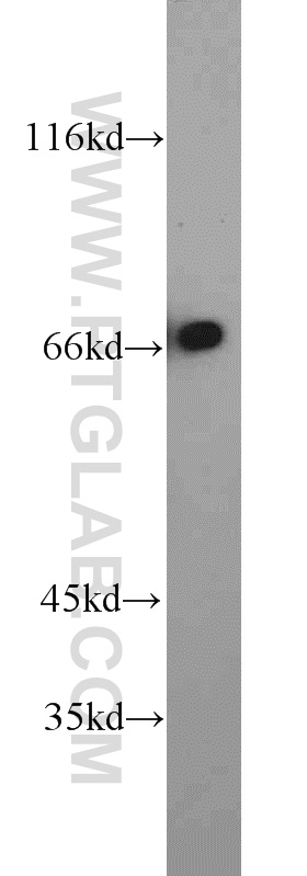 WB analysis of Jurkat using 22138-1-AP