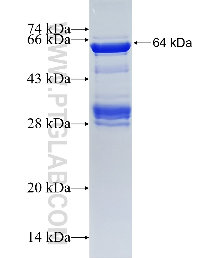 RYK fusion protein Ag17540 SDS-PAGE