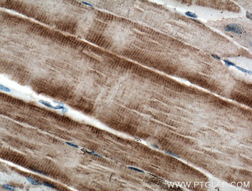 IHC staining of mouse skeletal muscle using 66539-1-Ig (same clone as 66539-1-PBS)
