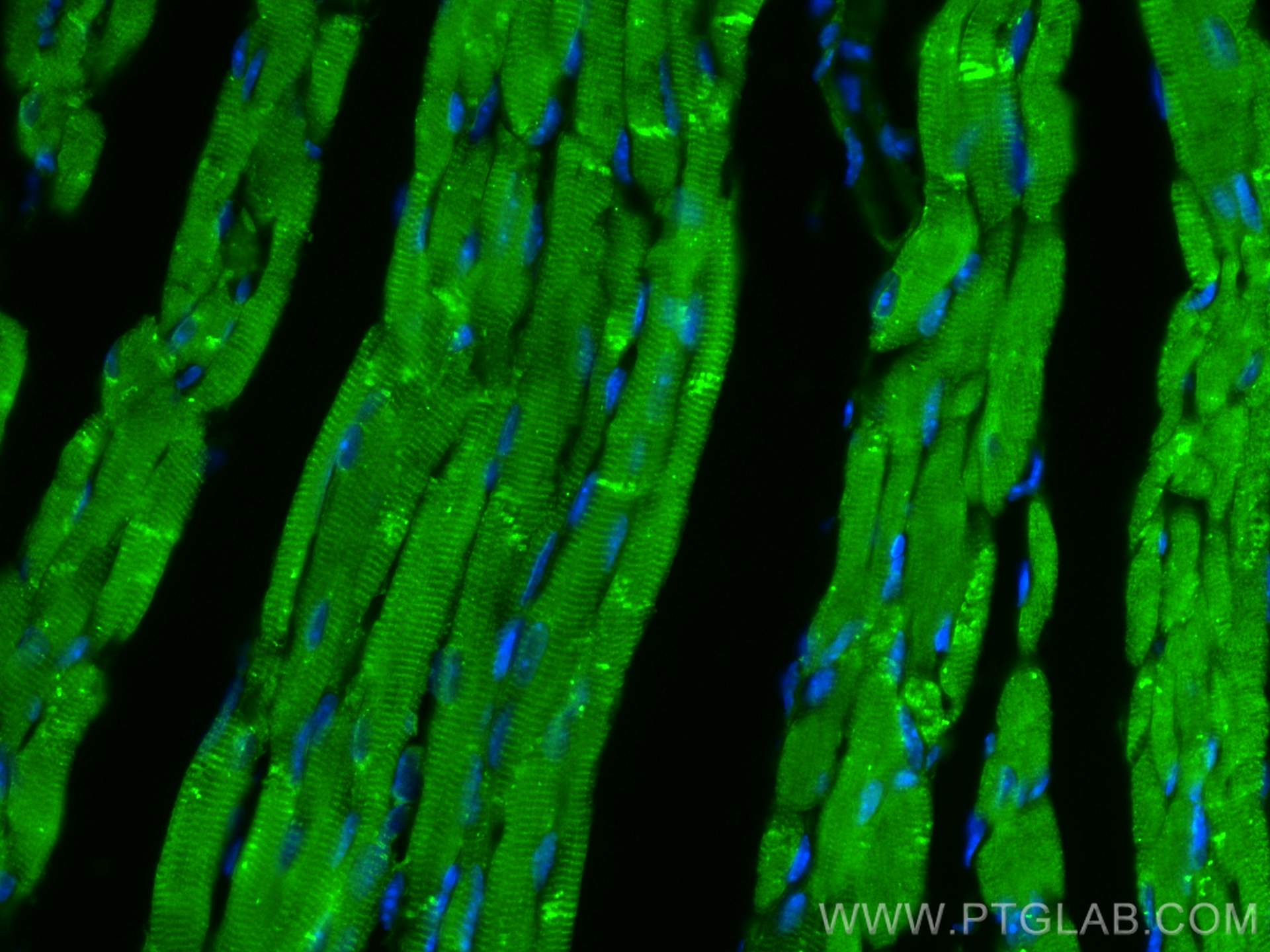 IF Staining of mouse heart using 19765-1-AP