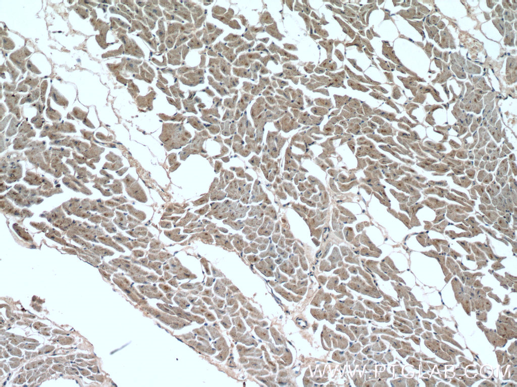 IHC staining of human heart using 19765-1-AP