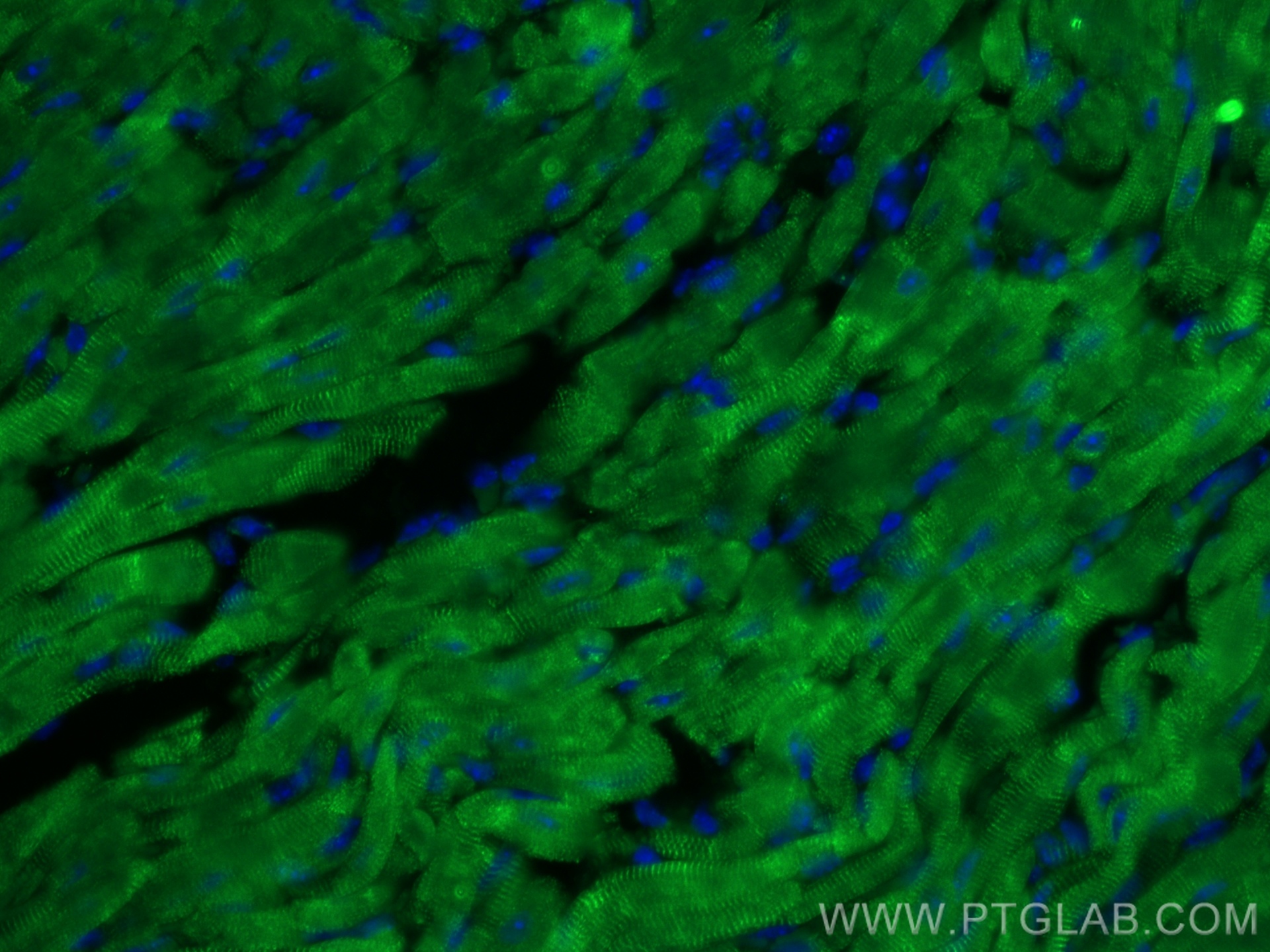 IF Staining of mouse heart using 27587-1-AP