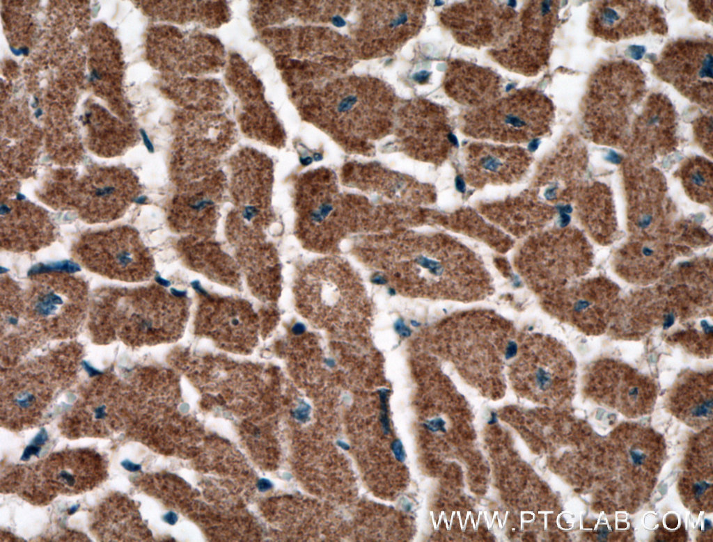 IHC staining of human heart using 27587-1-AP