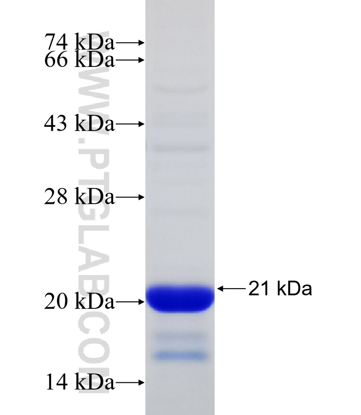 Rad51D fusion protein Ag32324 SDS-PAGE Rad51D fusion protein Ag32324 SDS-PAGE