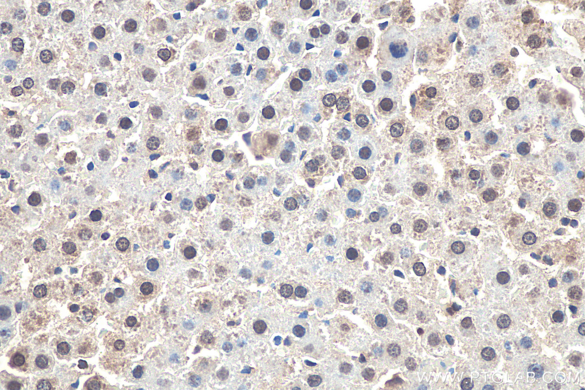 IHC staining of rat liver using 27606-1-AP