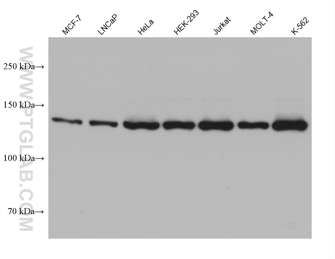 WB analysis using 68286-1-Ig (same clone as 68286-1-PBS)