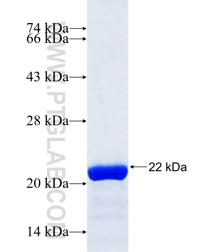 Reck fusion protein Ag37354 SDS-PAGE Reck fusion protein Ag37354 SDS-PAGE