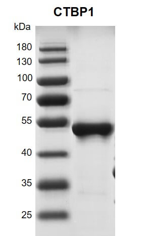Recombinant CTBP1 protein 10% SDS-PAGE Coomassie staining MW: 51.1 kDa Purity: >90% Recombinant CTBP1 protein 10% SDS-PAGE Coomassie staining MW: 51.1 kDa Purity: >90%