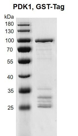 Recombinant PDK1 protein, GST-Tag 10% SDS-PAGE Coomassie staining MW: 89.8 kDa Purity: >70% Recombinant PDK1 protein, GST-Tag 10% SDS-PAGE Coomassie staining MW: 89.8 kDa Purity: >70%