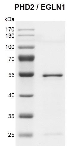Recombinant PHD2 (EGLN1) protein gel 10% SDS-PAGE gel with Coomassie blue staining MW: 47 kDa Purity: > 90% Recombinant PHD2 (EGLN1) protein gel 10% SDS-PAGE gel with Coomassie blue staining MW: 47 kDa Purity: > 90%