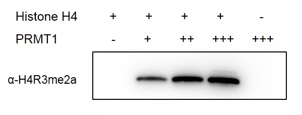 Prmtx Recombinant PRMT1 protein | Proteintech | 武汉三鹰生物技术有限公司