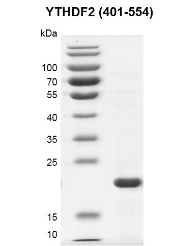 Recombinant YTHDF2 (401-554) SDS PAGE gel 12.5% SDS-PAGE Coomassie staining MW: 22.7 kDa Purity: >85% Recombinant YTHDF2 (401-554) SDS PAGE gel 12.5% SDS-PAGE Coomassie staining MW: 22.7 kDa Purity: >85%