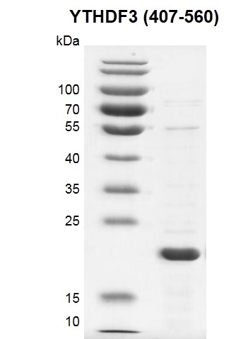 Recombinant YTHDF3 (407-560) SDS PAGE gel 12.5% SDS-PAGE gel with Coomassie Bluestaining MW: 22.6 kDa Purity: >80% Recombinant YTHDF3 (407-560) SDS PAGE gel 12.5% SDS-PAGE gel with Coomassie Bluestaining MW: 22.6 kDa Purity: >80%