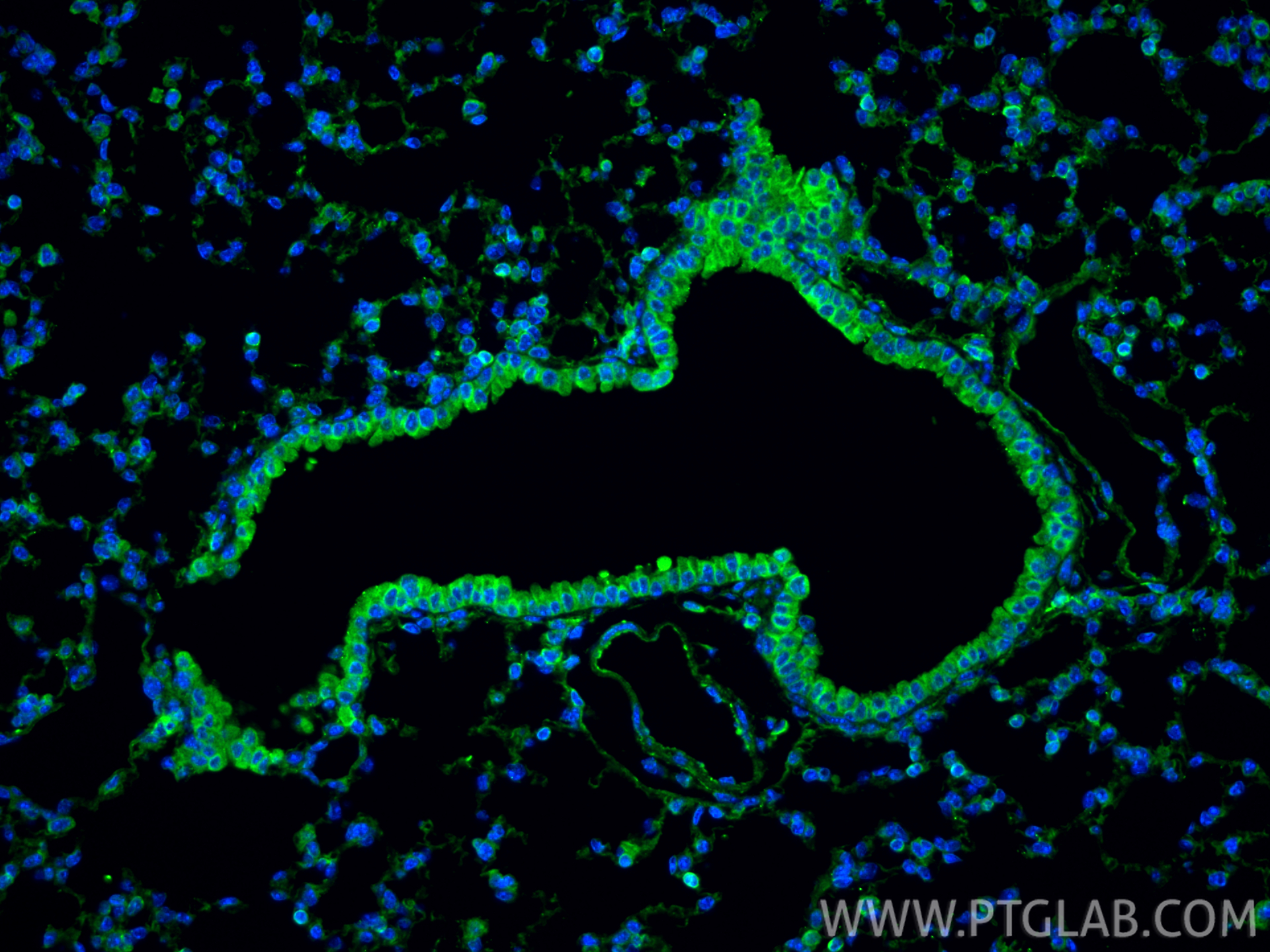 IF Staining of mouse lung using 33259-1-AP