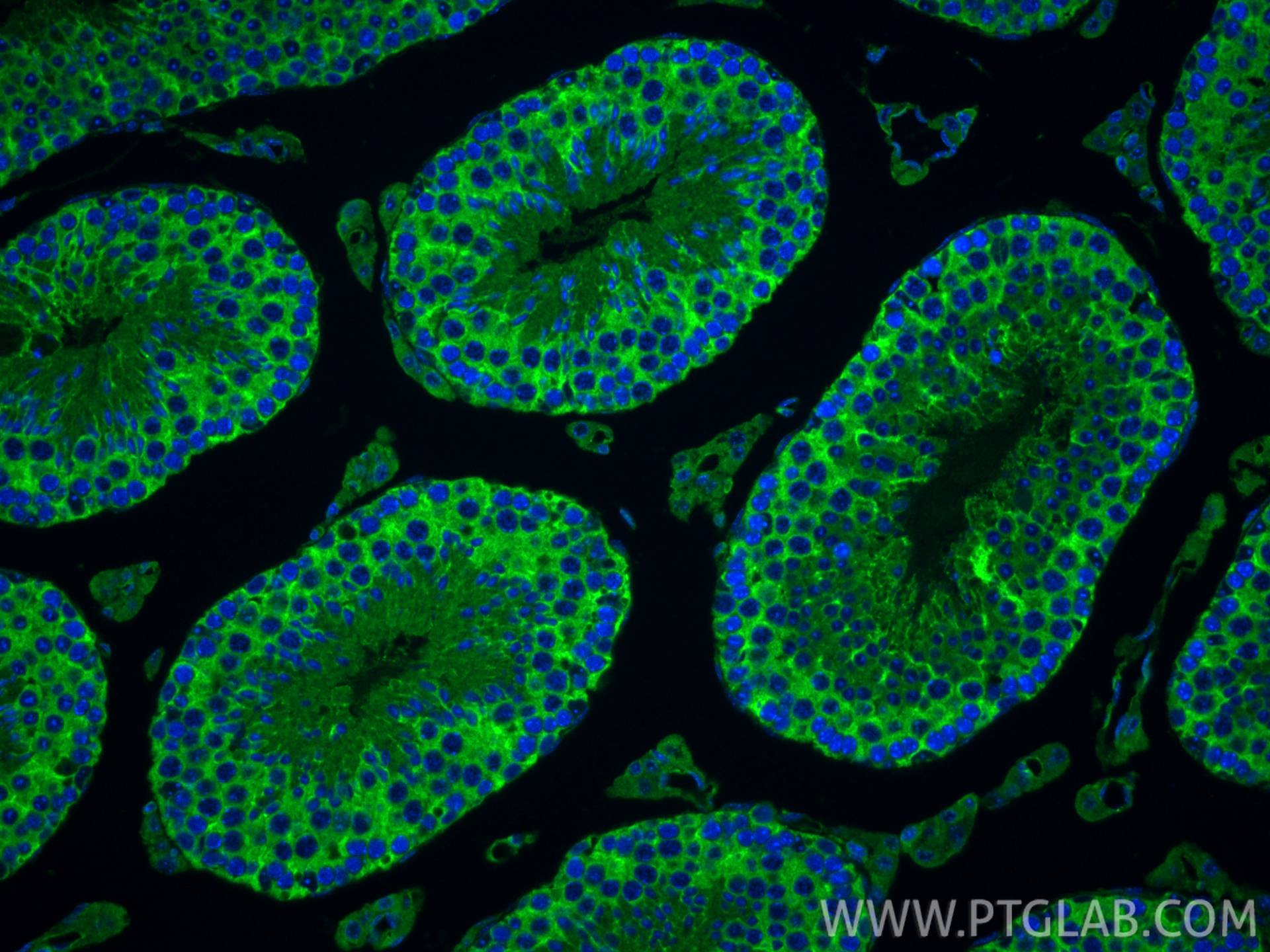 IF Staining of mouse testis using 33259-1-AP