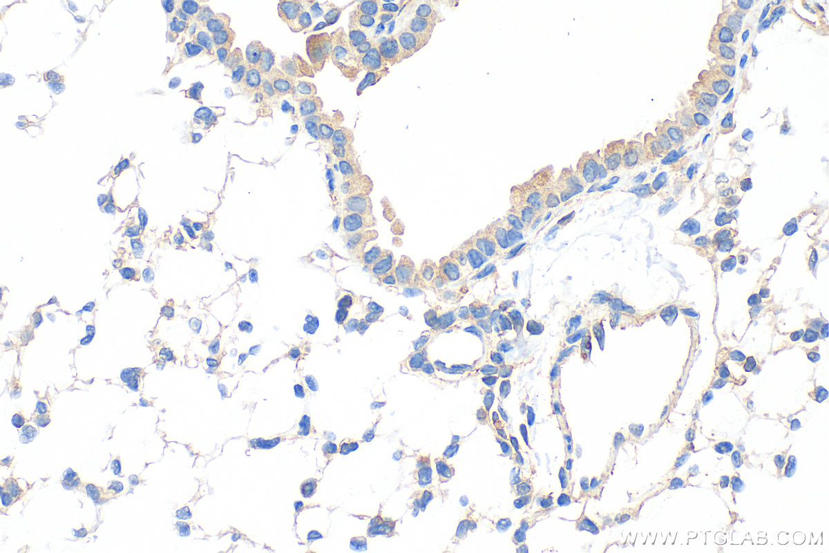 IHC staining of mouse lung using 33259-1-AP