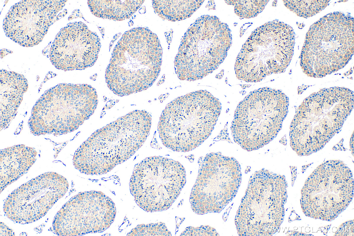 IHC staining of mouse testis using 33259-1-AP