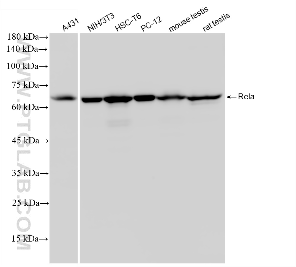 WB analysis using 87545-1-RR