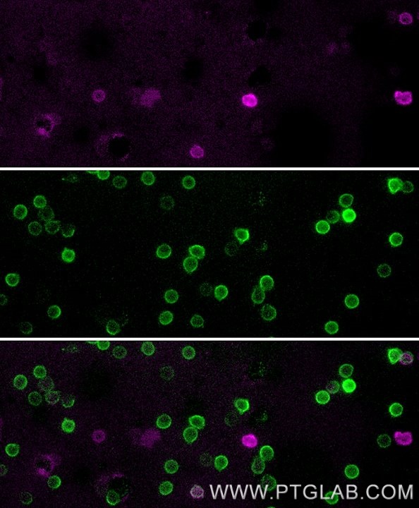 Live human PBMCs were gravity-sedimented and immunostained with anti-CD16 recombinant VHH, CoraLite ® Plus 647 (CL647-CD16, magenta) and anti-CD3 IgG-CL488 (CL488-65151, green). Images were acquired with a 20x objective and post-processed. Dead cells (autofluorescent in all channels including UV and far-red) we subtracted from all channels with ImageJ.
Note: Immunostaining with CL647-CD16 can be performed live or after formaldehyde fixation.