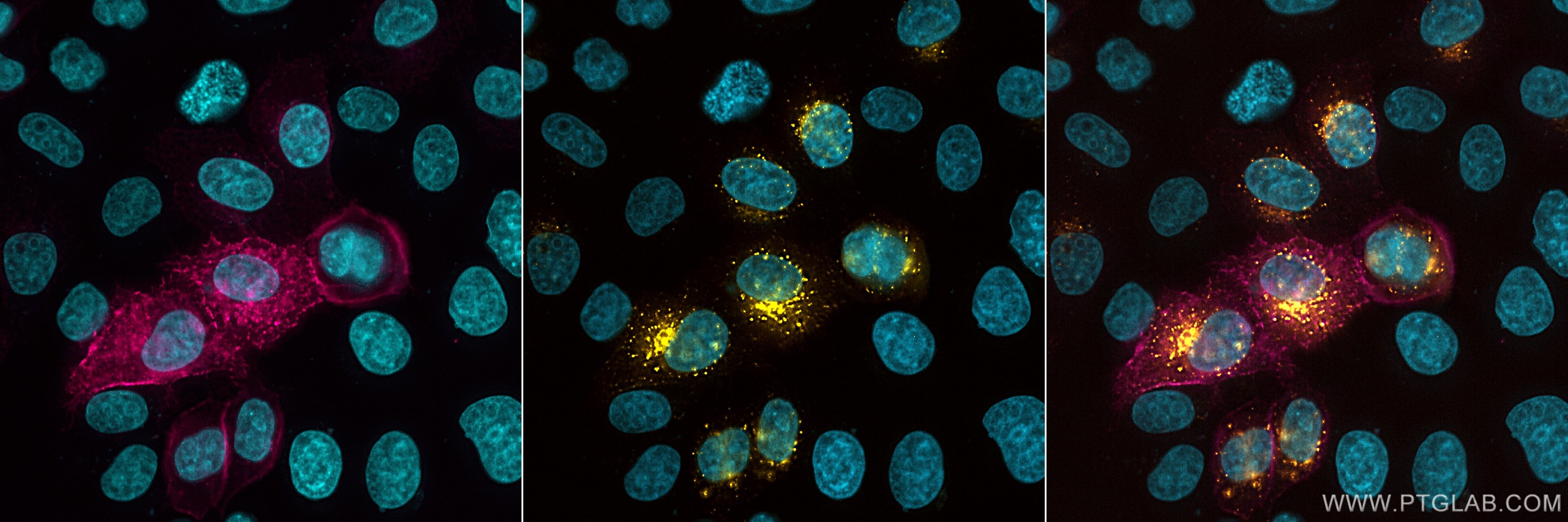 Live HeLa cells transfected with human TIGIT were immunostained with CoraLite® Plus 647 conjugated-TIGIT VHH (CL647-tgt,1:1000, magenta). After formaldehyde fixation, triton permeabilization and blocking with BSA, the intracellular pool of TIGIT was immunostained with CoraLite® Plus 555 conjugated-TIGIT VHH (CL555-tgt,1:1000, yellow). Cell nuclei were stained with DAPI (cyan). Epifluorescence images were acquired and post-processed with Leica Thunder Imager, 40x objective.