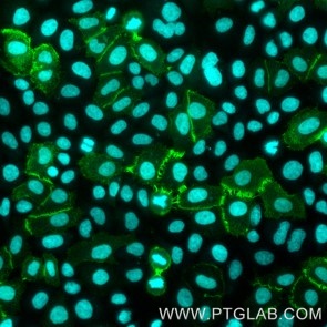 Live HeLa cells transfected with human LAG3 were immunostained FITC Plus conjugated-LAG3 VHH (FITC-lt, 1:500, green). Cells were fixed and nuclei were stained with DAPI (cyan). Epifluorescence images were acquired with a 20x objective and post-processed. 
Note: Immunostaining with FITC-lt can also be performed after formaldehyde fixation of the cells.