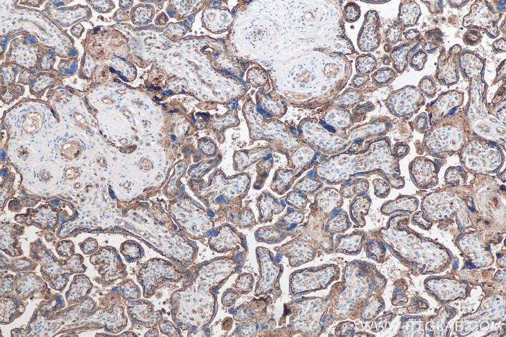 使用 Proteintech 的 SLC2A3 兔多克隆抗体 (20403-1-AP) 和抗小鼠/兔通用型免疫组化检测试剂盒 (PK10006) 对人胎盘组织进行免疫组织化学分析。