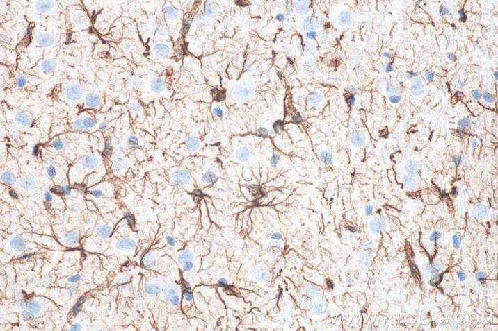 使用 Proteintech 的 GFAP 小鼠单克隆抗体 (60190-1-Ig) 和抗小鼠免疫组化检测试剂盒 (PK10010) 对大鼠脑组织进行免疫组织化学分析。