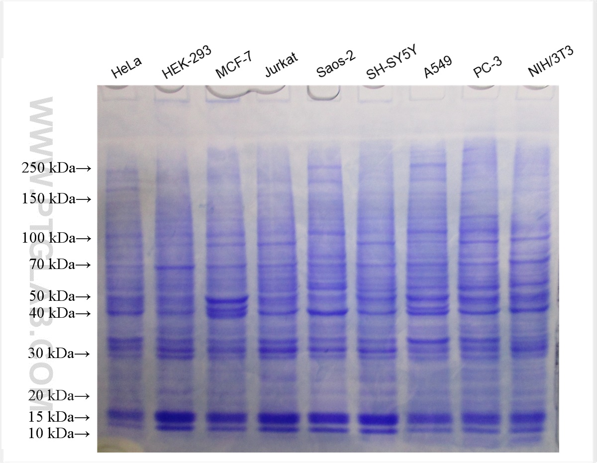 SDS-PAGE胶 考马斯亮蓝染色图。
胶浓度：8-18%梯度胶；
上样量：30 μg。