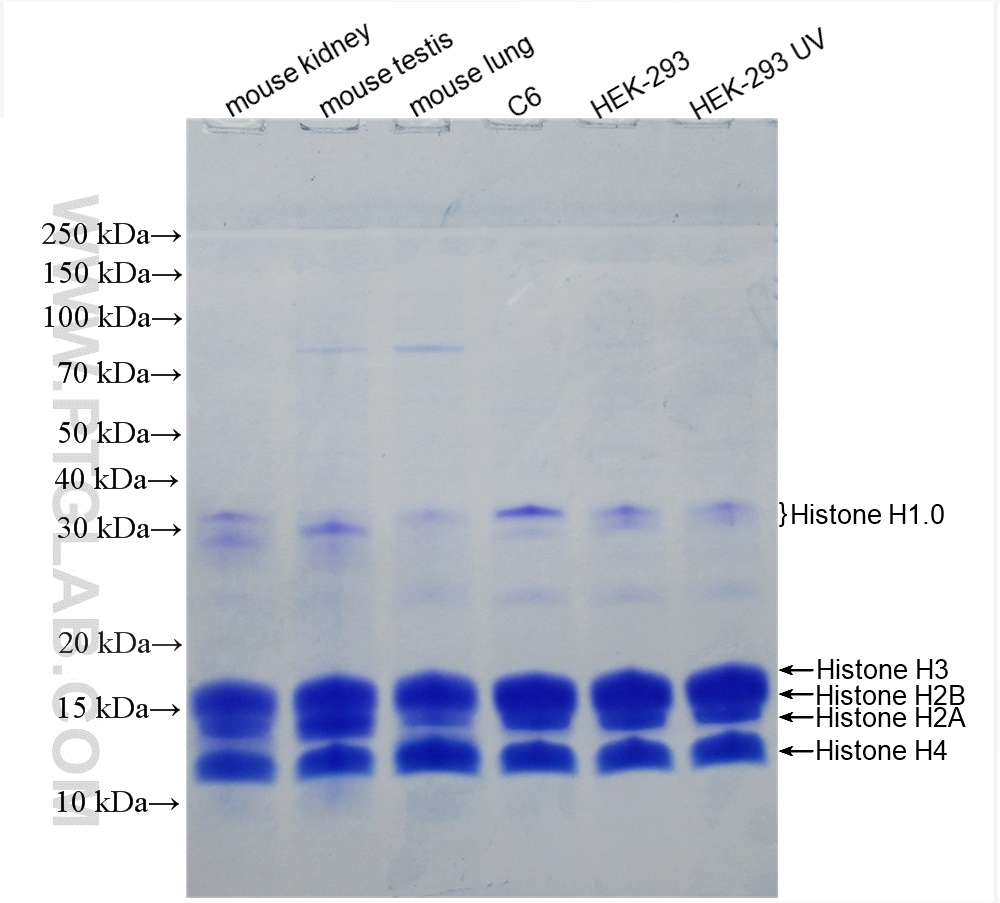 使用组蛋白抽提试剂盒（货号：PK10022)提取的组蛋白样品。
SDS-PAGE 考马斯亮蓝染色图。
胶浓度：10% Tricine-SDS-PAGE胶；
上样量：10 ug；
lane1: mouse kidney tissue histone；
lane2: mouse testis tissue histone；
lane3: mouse lung tissue histone；
lane4: C6 cells histone；
lane5: HEK-293 cells histone；
lane6: UV treated HEK-293 cells histone
