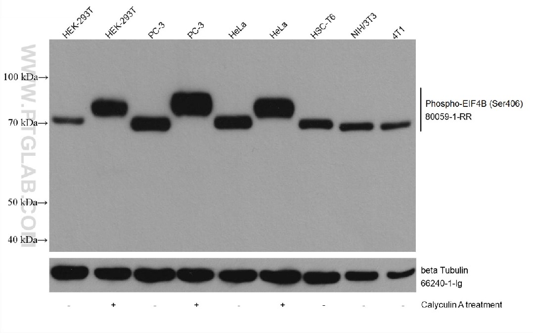 Non-treated and Calyculin A treated cells were subjected to SDS PAGE followed by western blot with 80059-1-RR (Phospho-EIF4B (Ser406) antibody) at dilution of 1:2000 incubated at room temperature for 1.5 hours.
