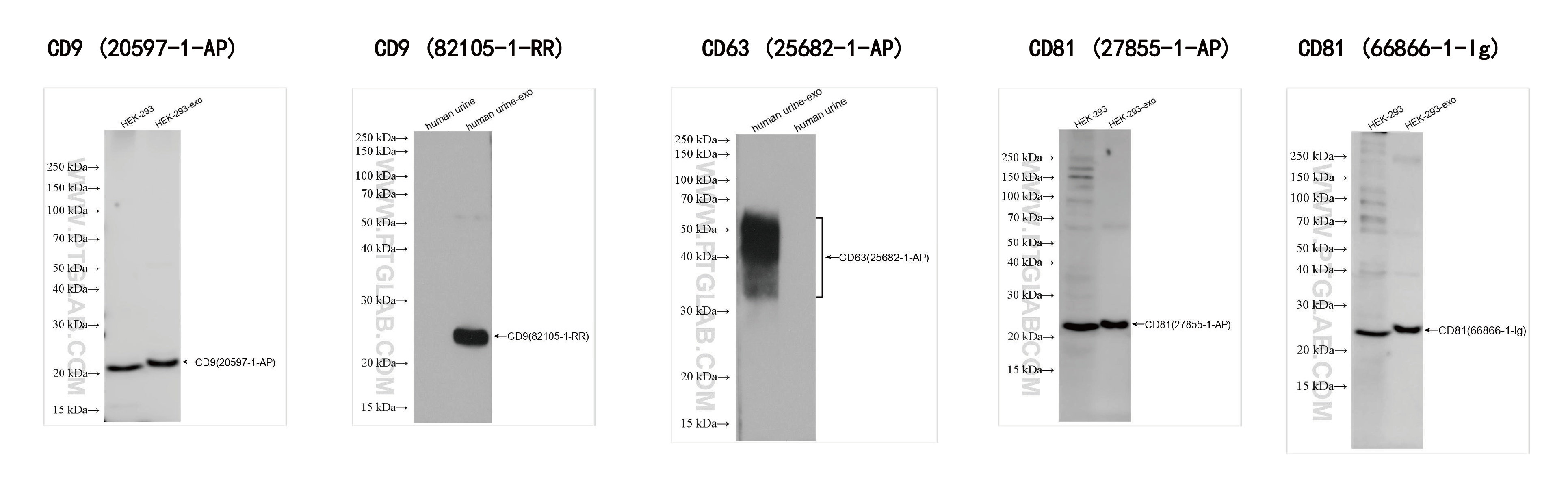 使用外泌体分离及蛋白提取试剂盒（细胞培养上清/尿液）（货号：PK10028）提取的human urine-derived exosomes (human urine-exo)和HEK-293-derived exosomes (HEK-293-exo)外泌体膜蛋白检测。
<br>抗体：
<br>CD9    20597-1-AP  稀释度：1:1000;
<br>CD9    82105-1-RR  稀释度：1: 5000;
<br>CD63  25682-1-AP  稀释度：1: 1000;
<br>CD81  27855-1-AP  稀释度：1:2000;
<br>CD81  66866-1-Ig    稀释度：1:8000。