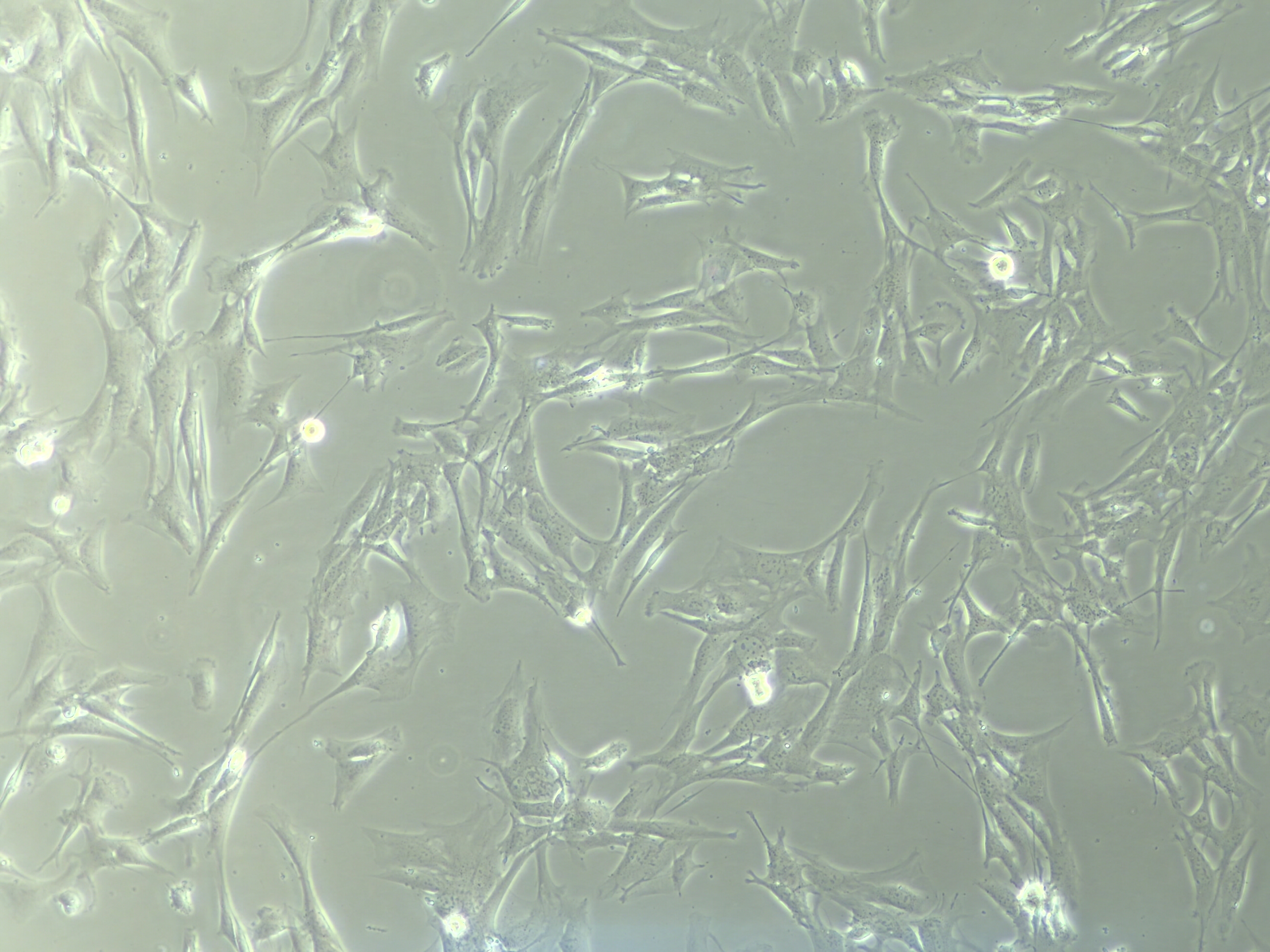 此图为小鼠间充质干细胞（mMSCs）以Proteintech特级胎牛血清配制完全培养基培养后所摄细胞形态图片。