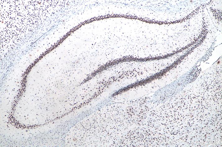 使用 Proteintech 的 TDP-43 兔重组抗体 (80001-1-RR) 对大鼠脑组织进行免疫组织化学分析。使用柠檬酸钠抗原修复液 (PR30001) 进行热诱导抗原表位修复。