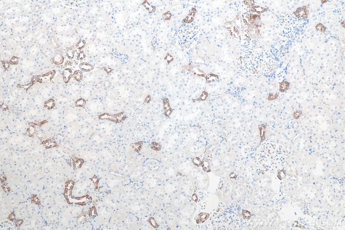 使用 Proteintech 的 AQP2 兔多克隆抗体 (29386-1-Ap) 对大鼠肾组织进行免疫组织化学分析。使用柠檬酸钠抗原修复液 (PR30001) 进行热诱导抗原表位修复。