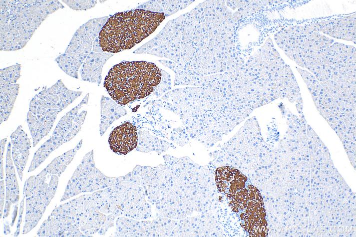 使用 Proteintech 的 Synaptophysin 兔多克隆抗体 (17785-1-AP) 对小鼠胰腺组织进行免疫组织化学分析。使用Tris-EDTA 抗原修复液 (PR30002) 进行热诱导抗原表位修复。