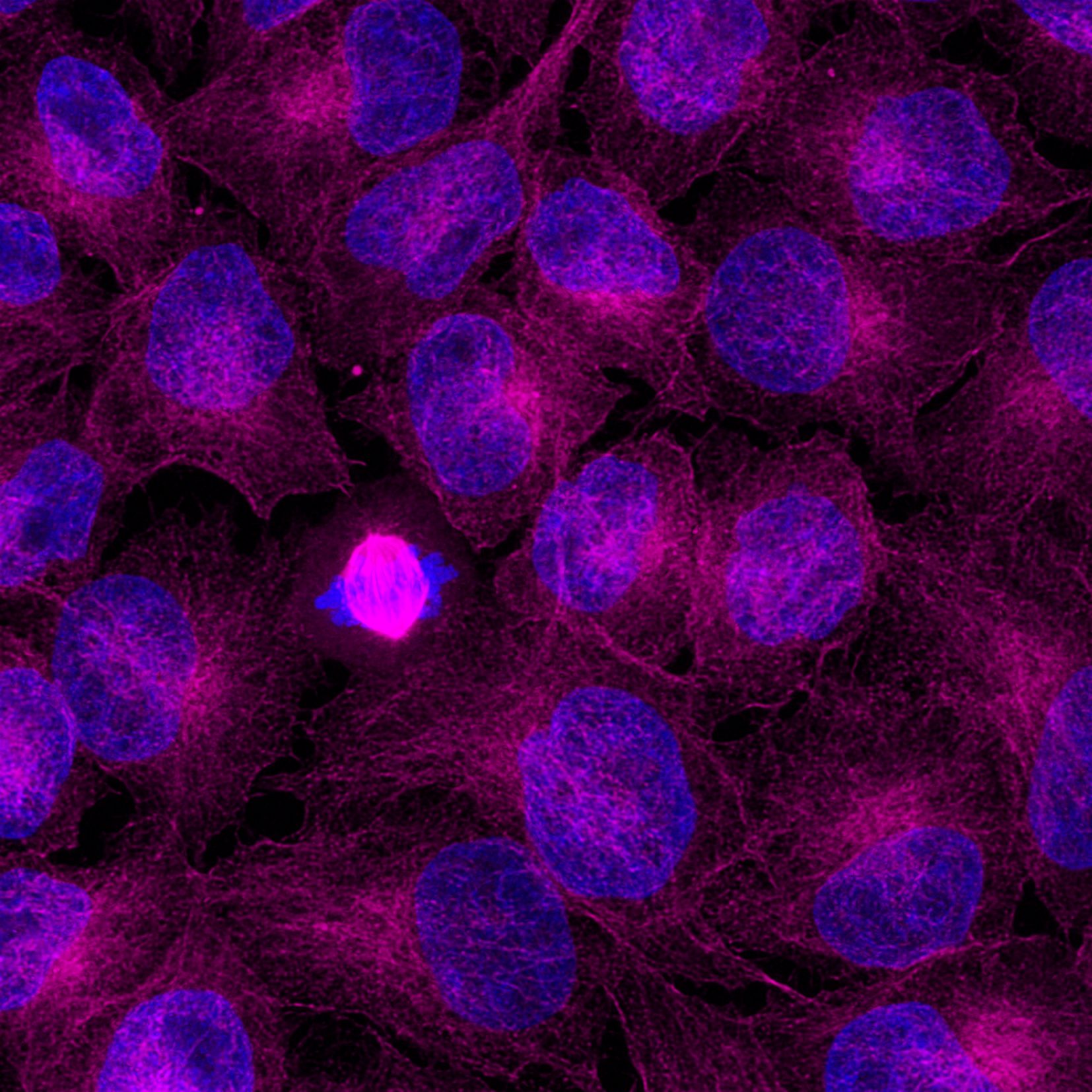 Immunofluorescence analysis of Hela cells stained with mouse IgG2a anti-Tubulin antibody (66240-1-Ig) and Nano-Secondary® alpaca anti-mouse IgG2a, recombinant VHH, CoraLite® Plus 647 (magenta). Nuclei were stained with DAPI (blue). Images were recorded at the Core Facility Bioimaging at the Biomedical Center, LMU Munich.