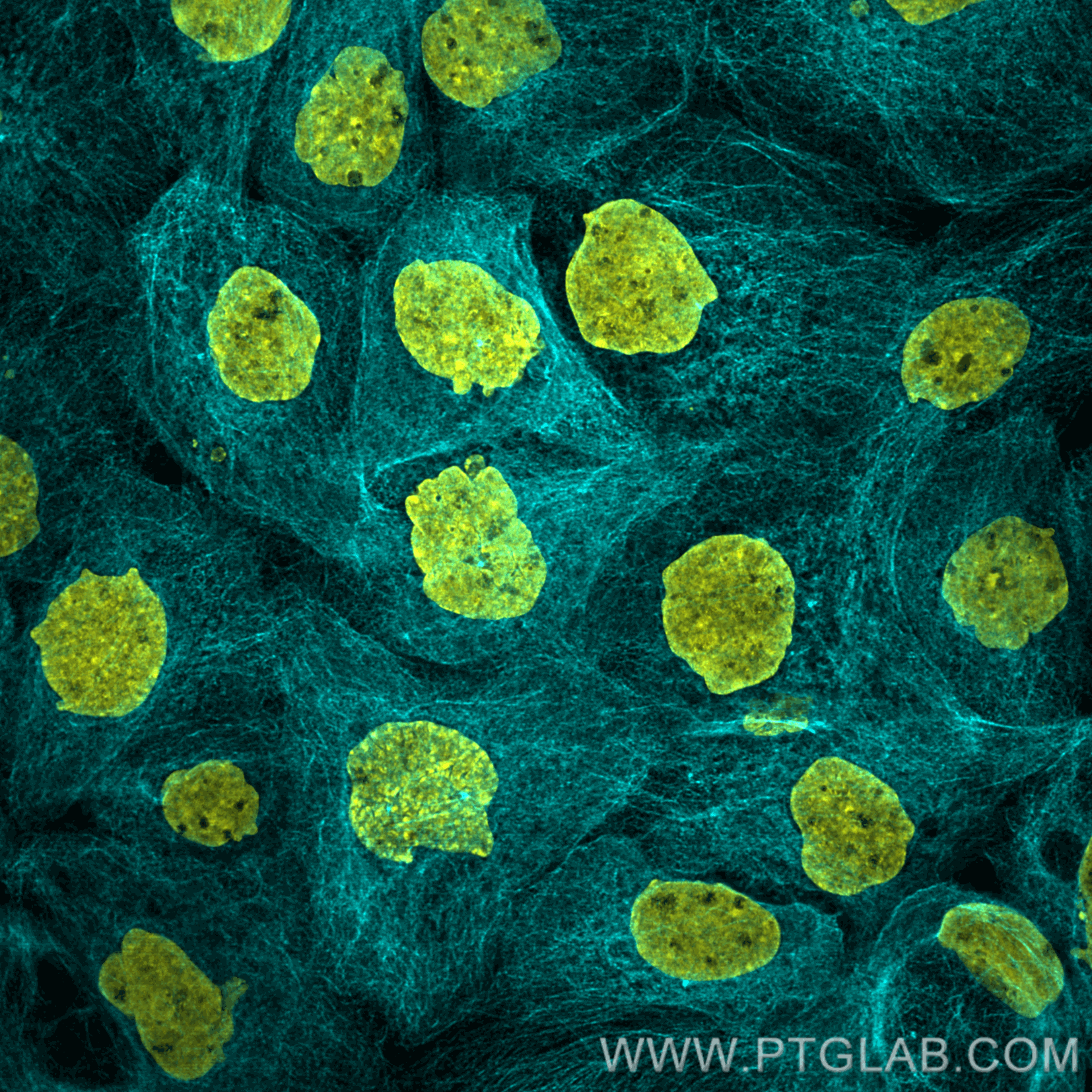 Immunofluorescence analysis of A431 cells stained with rabbit anti-tubulin antibody (80713-1-AP, cyan) and Nano-Secondary® alpaca anti-rabbit IgG, recombinant VHH, CoraLite® Plus 750 (srb2GCL750-1), 1:500. Nuclei were stained with DAPI. Images were recorded at the Core Facility Bioimaging at the Biomedical Center, LMU Munich.