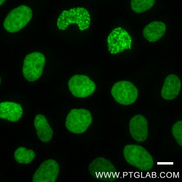 Hela cells immunostained with Histone-Lable-ATTO488, 1:400. Scale bar, 10 um.