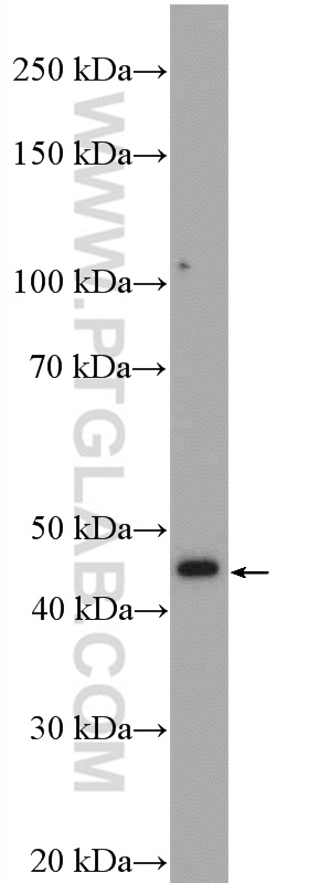 Reticulocalbin 3