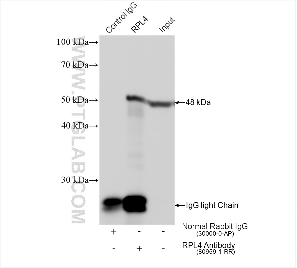 IP experiment of HeLa using 80959-1-RR