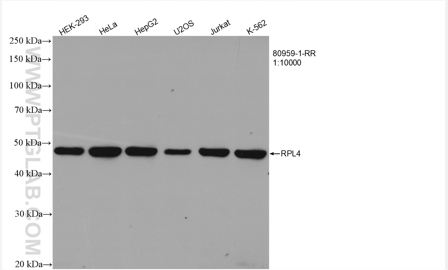 Ribosomal protein L4