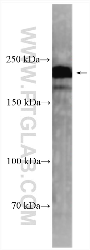 WB analysis of mouse brain using 55485-1-AP