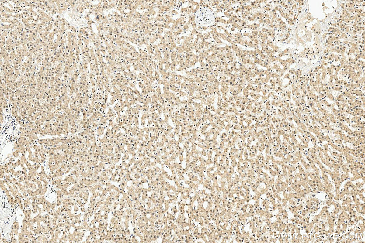 IHC staining of human liver using 27865-1-AP